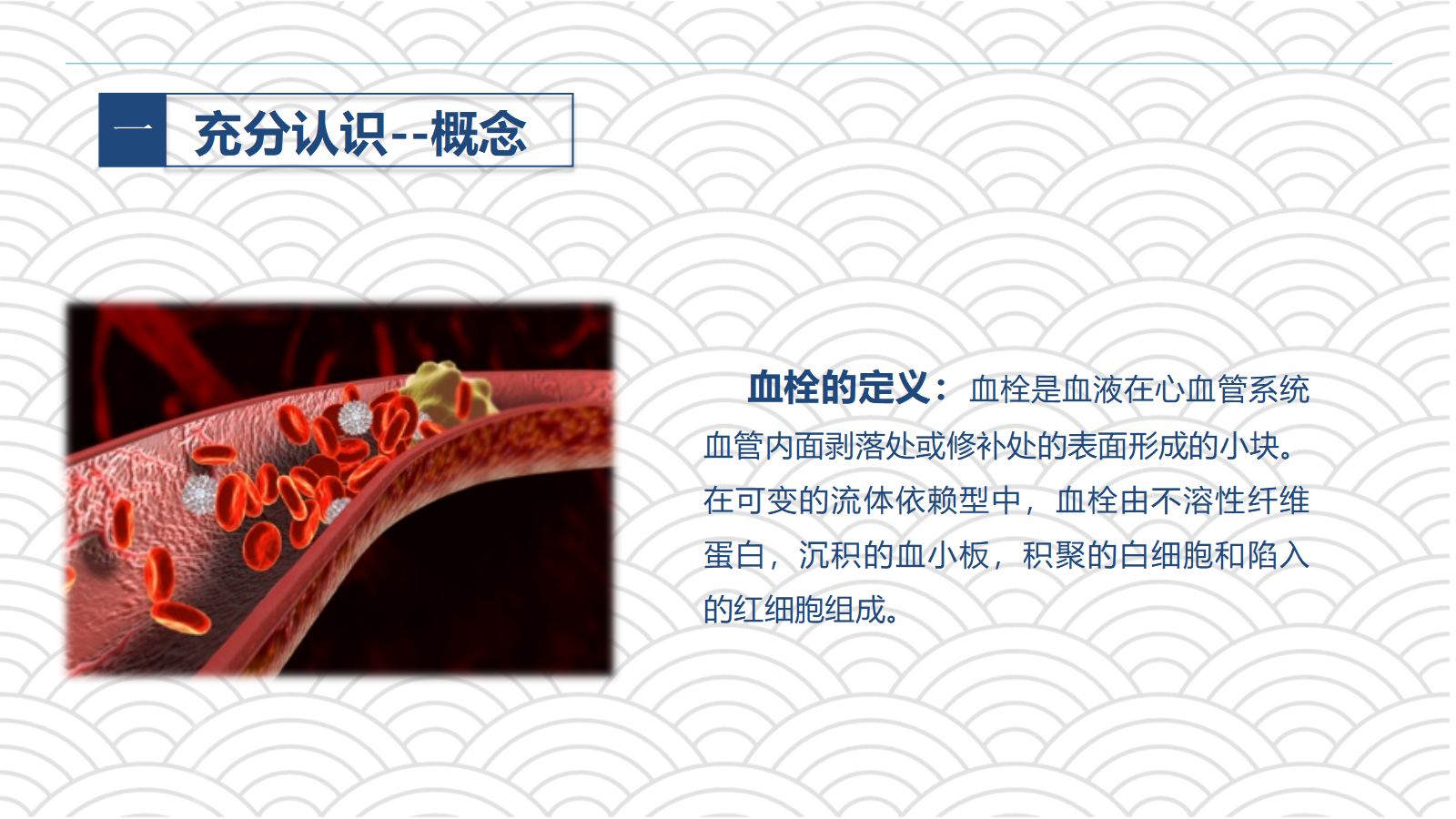 PICC相关静脉血栓护理的业务学习 第4页
