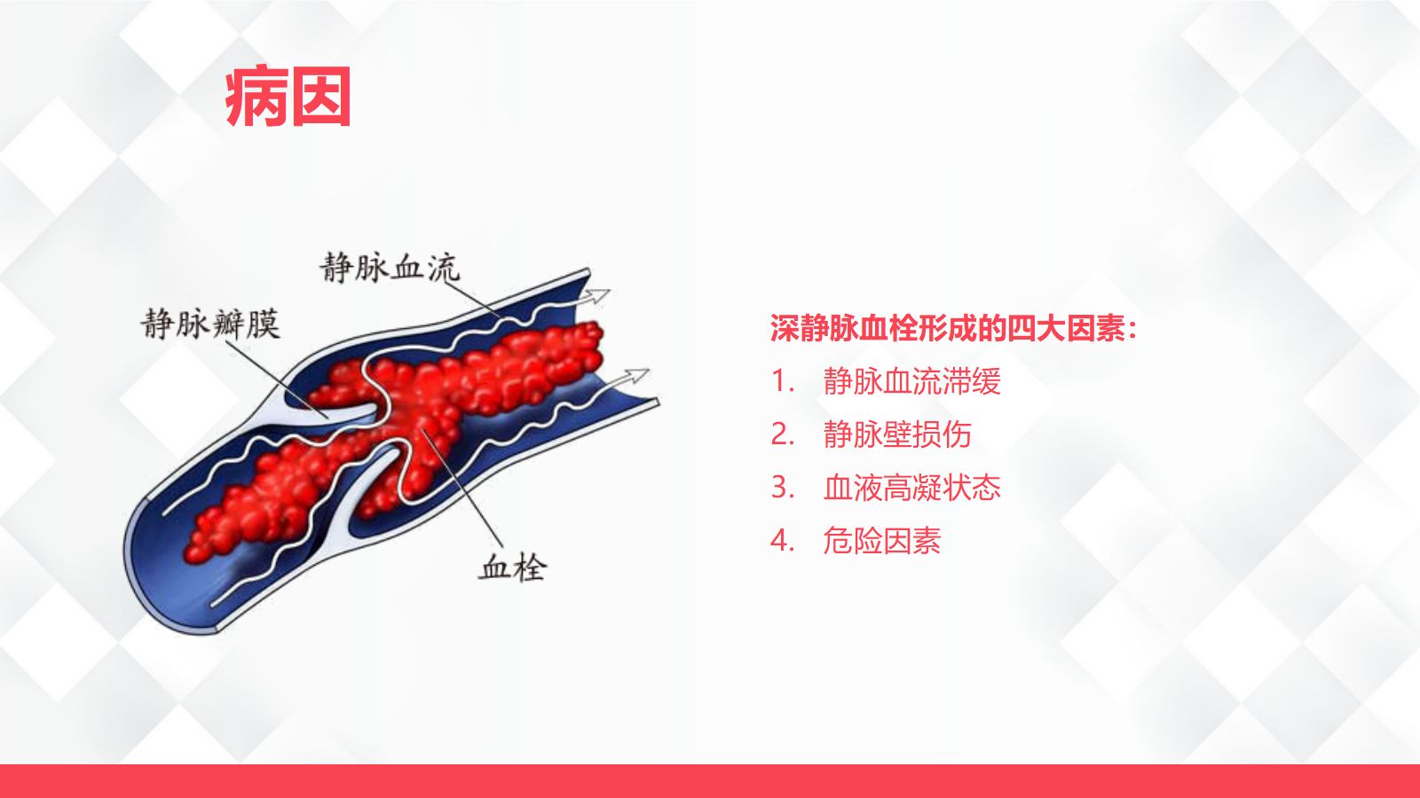 深静脉血栓的护理-业务学习 第5页