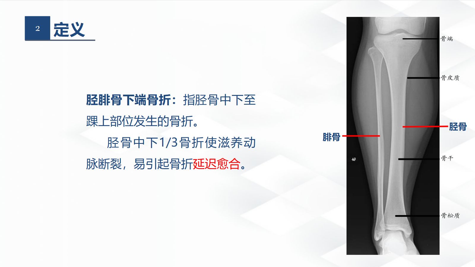06骨科-胫腓骨骨折教育查房 第5页