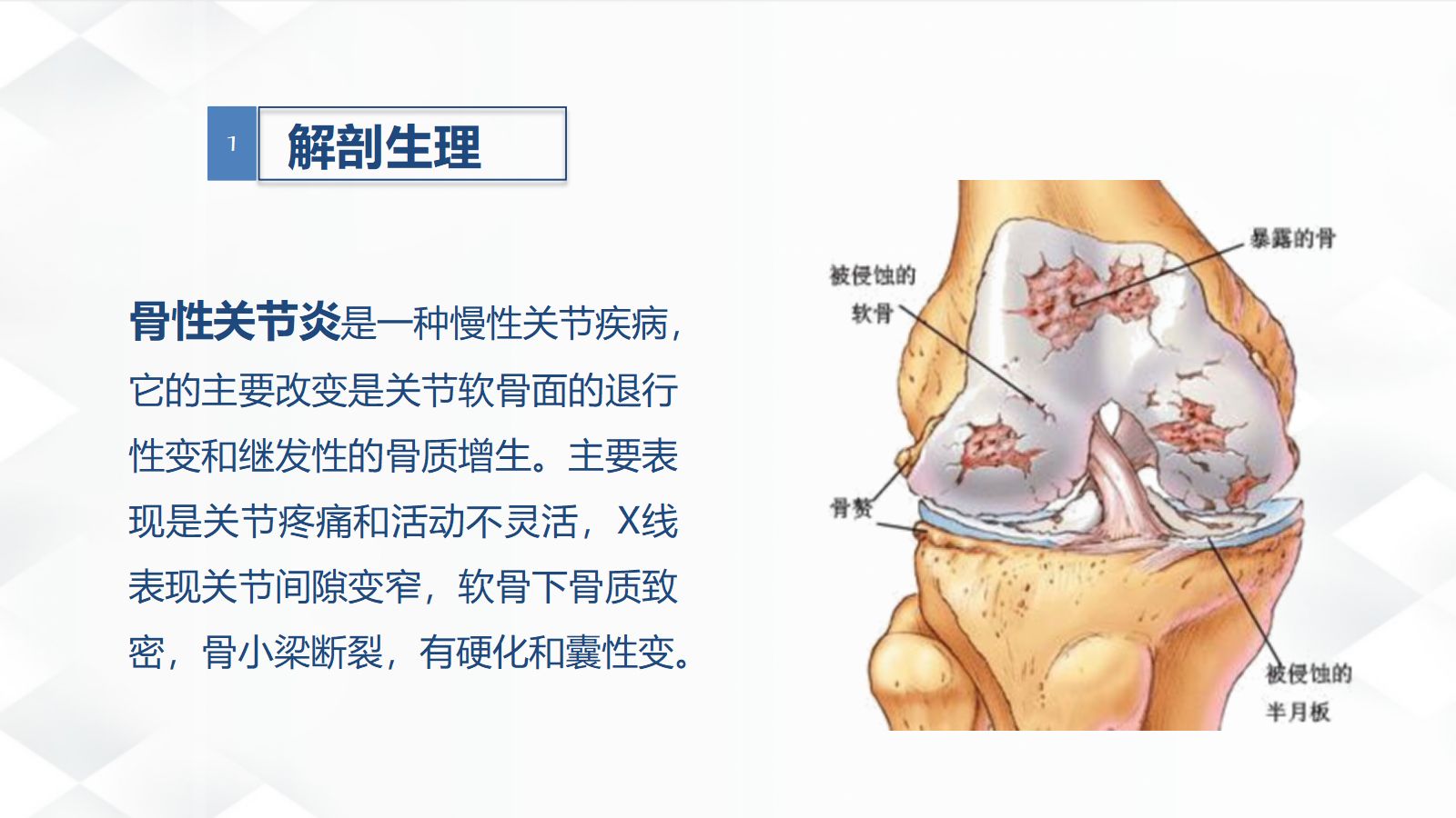08骨科-双膝骨性关节炎护理查房(2) 第4页