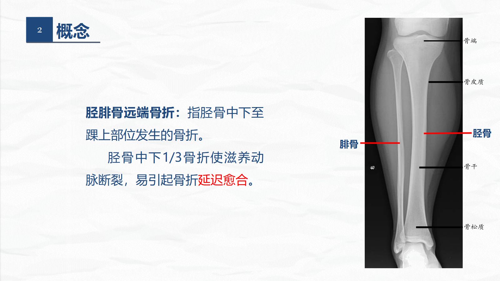 09骨科-右胫腓骨远端骨折术合并骨盆骨折的护理查房 第5页