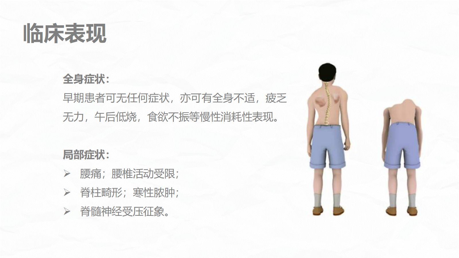 腰椎结核的围手术期护理 第5页