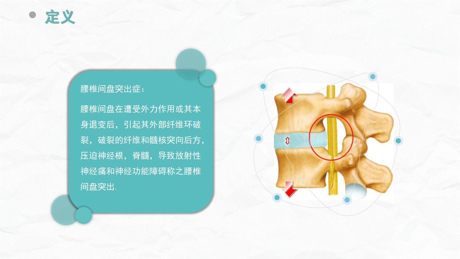 腰椎间盘突出症的康复护理 第5页