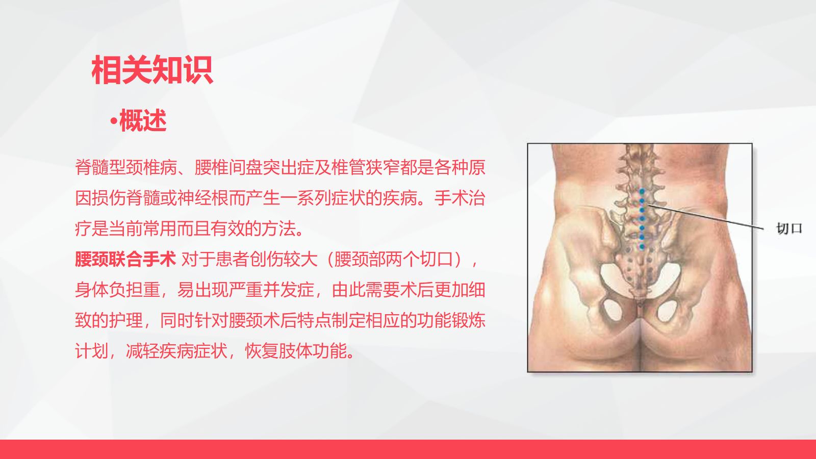 腰颈椎联合手术患者术后护理 第4页