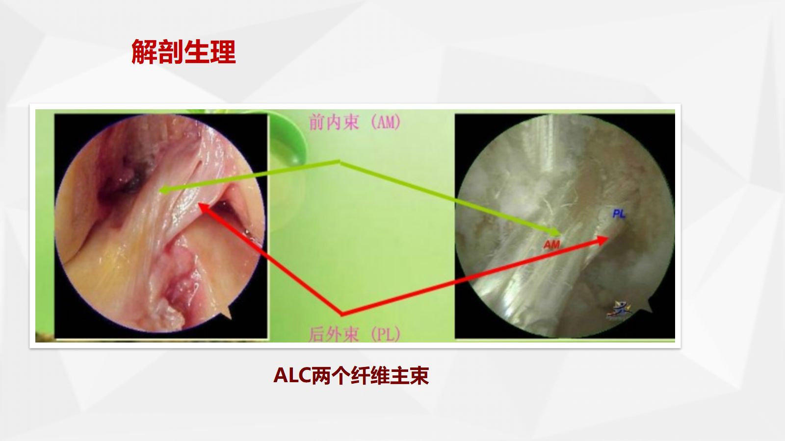 膝关节前十字韧带重建术的健康教育 第5页