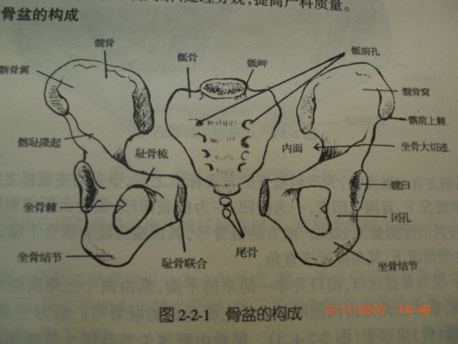 骨盆骨折护理PPT幻灯片 第5页