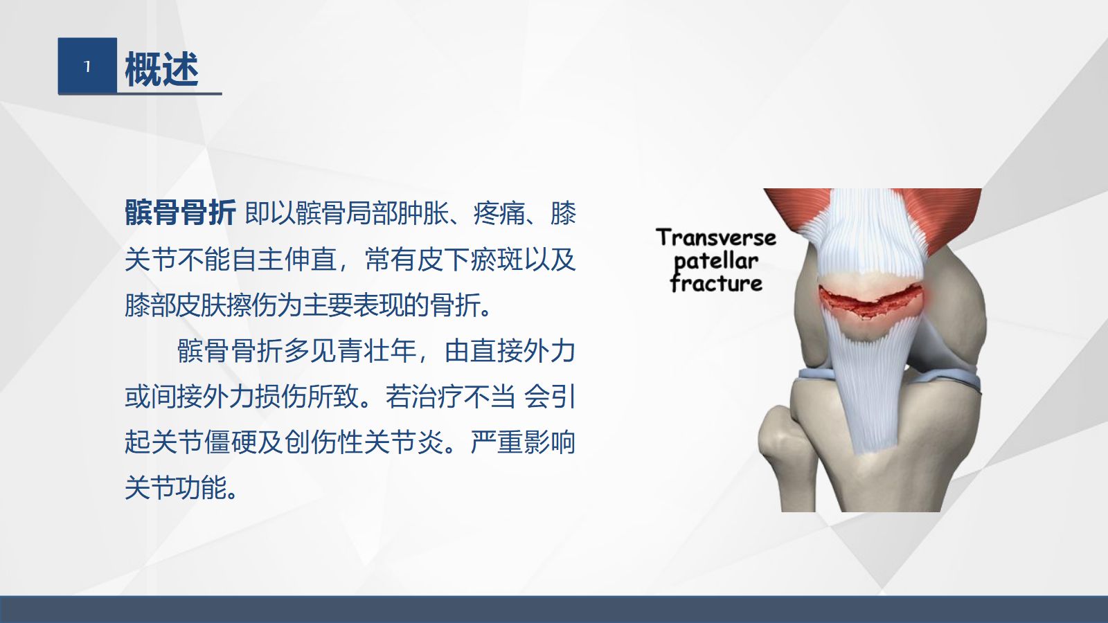 髌骨骨折的护理 第4页
