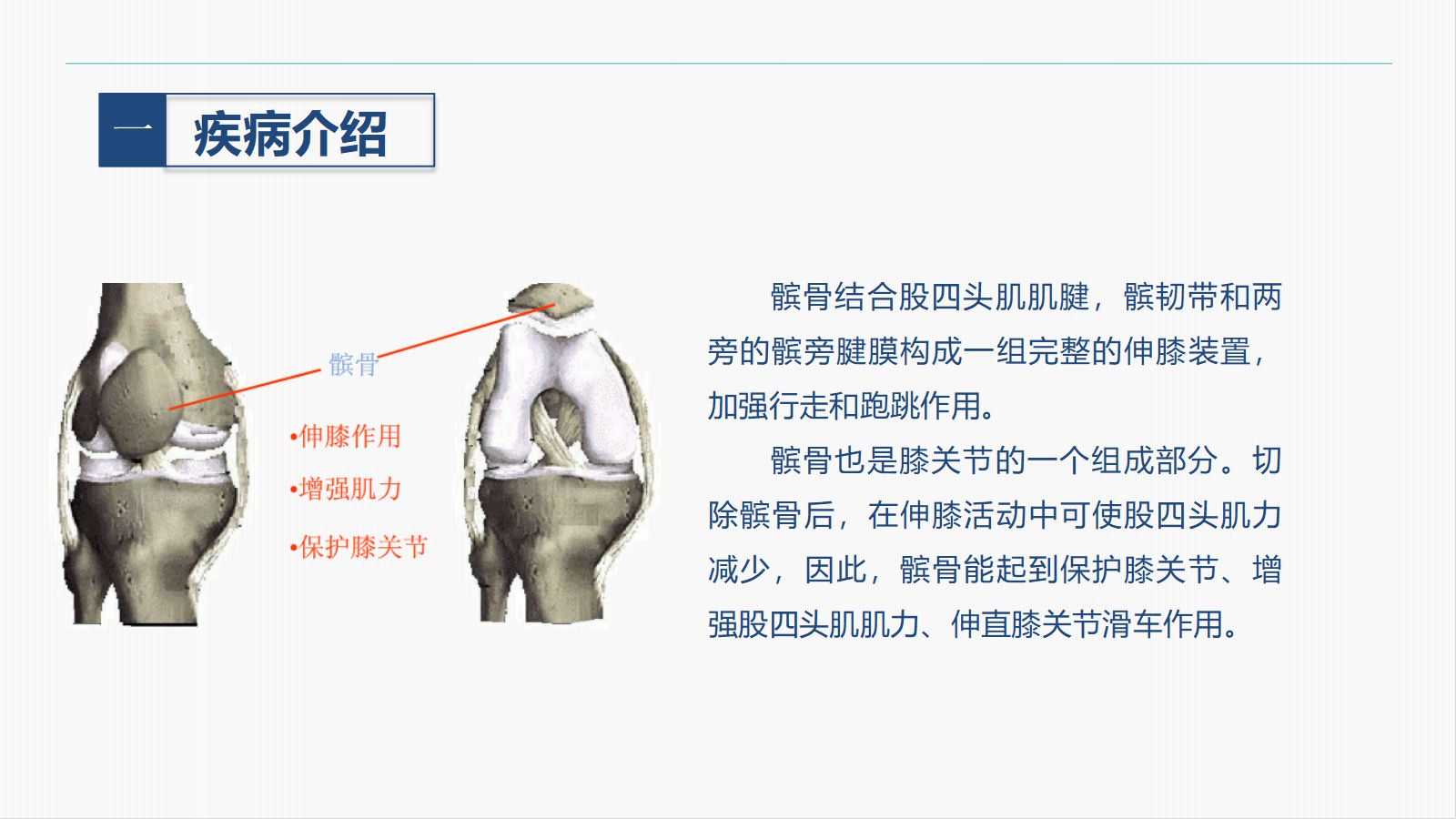 髌骨骨折的护理查房 第4页