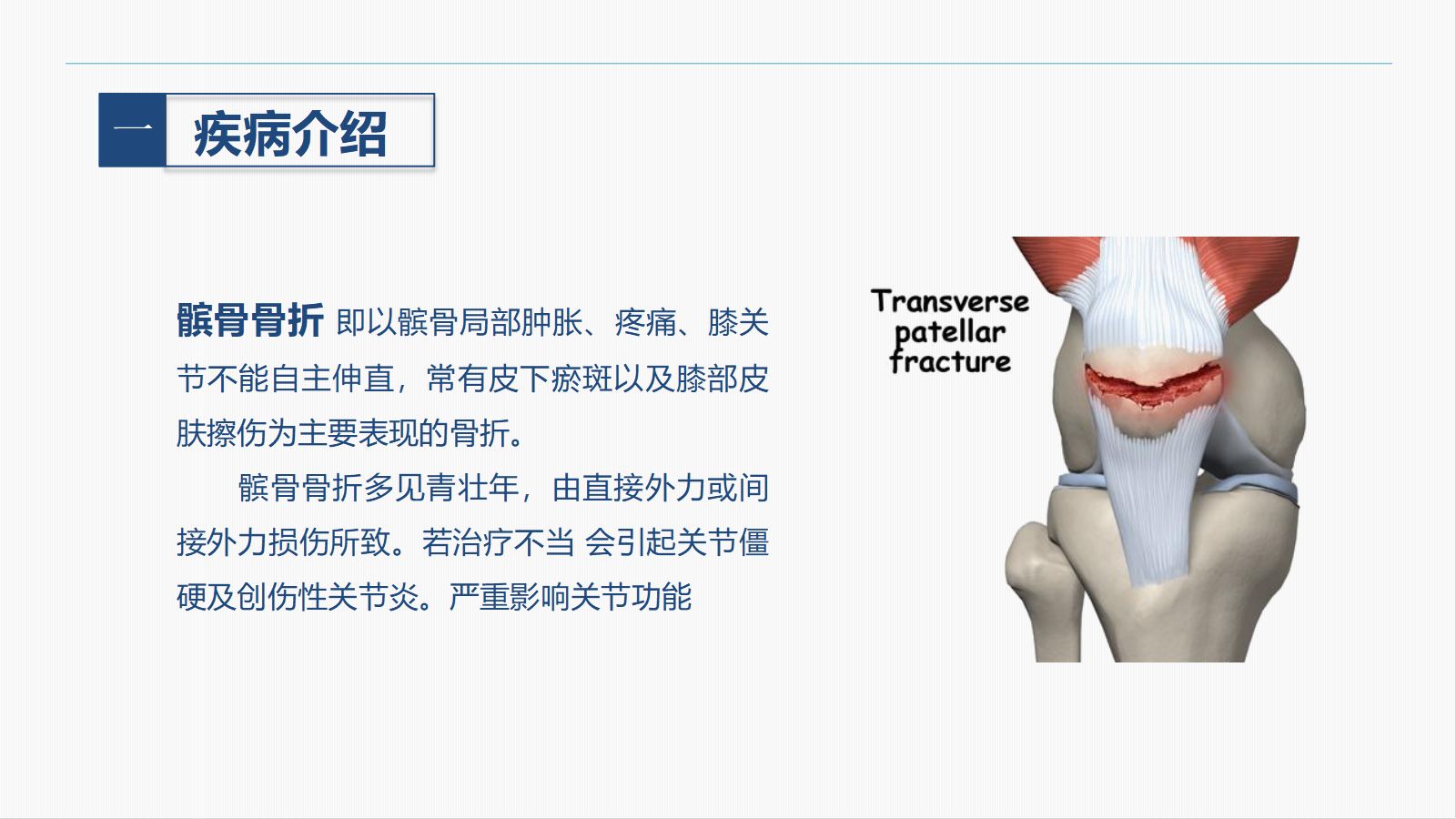 髌骨骨折的护理查房 第5页