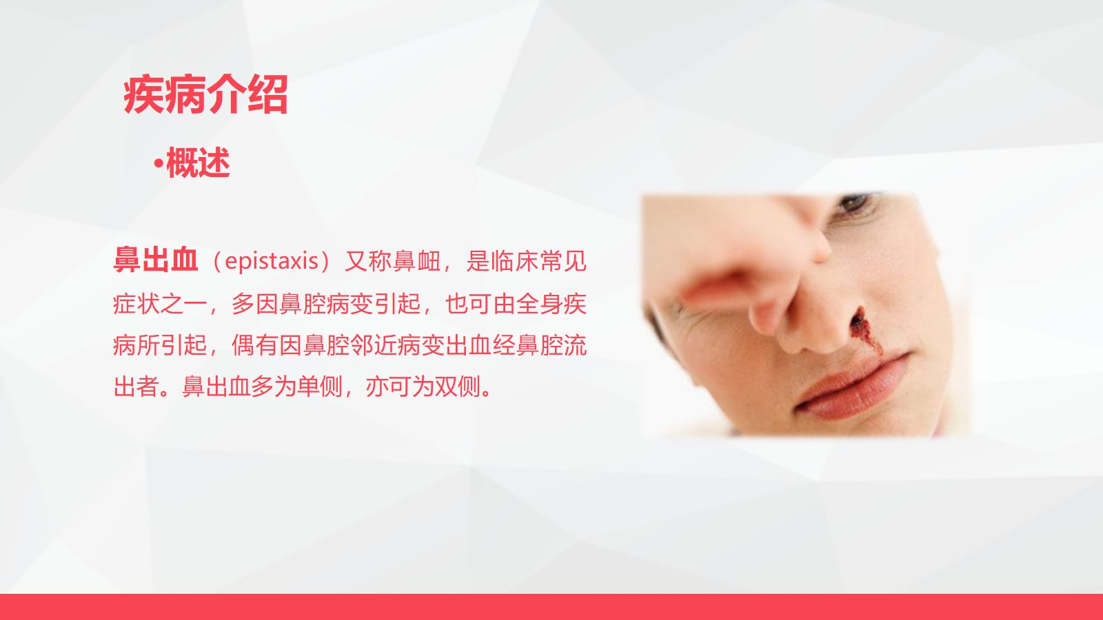 鼻出血的业务学习 第4页