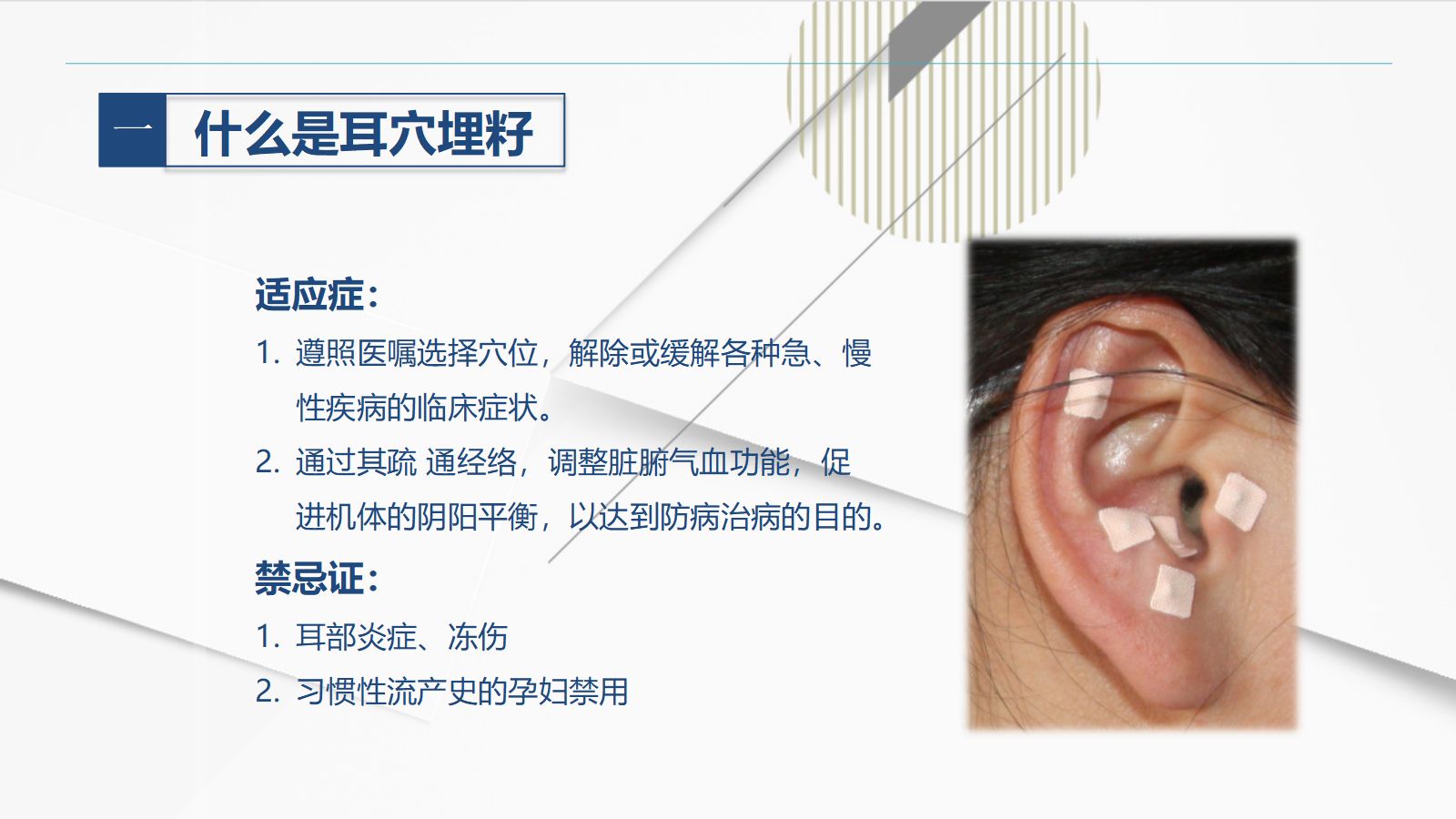 耳穴埋籽 第5页